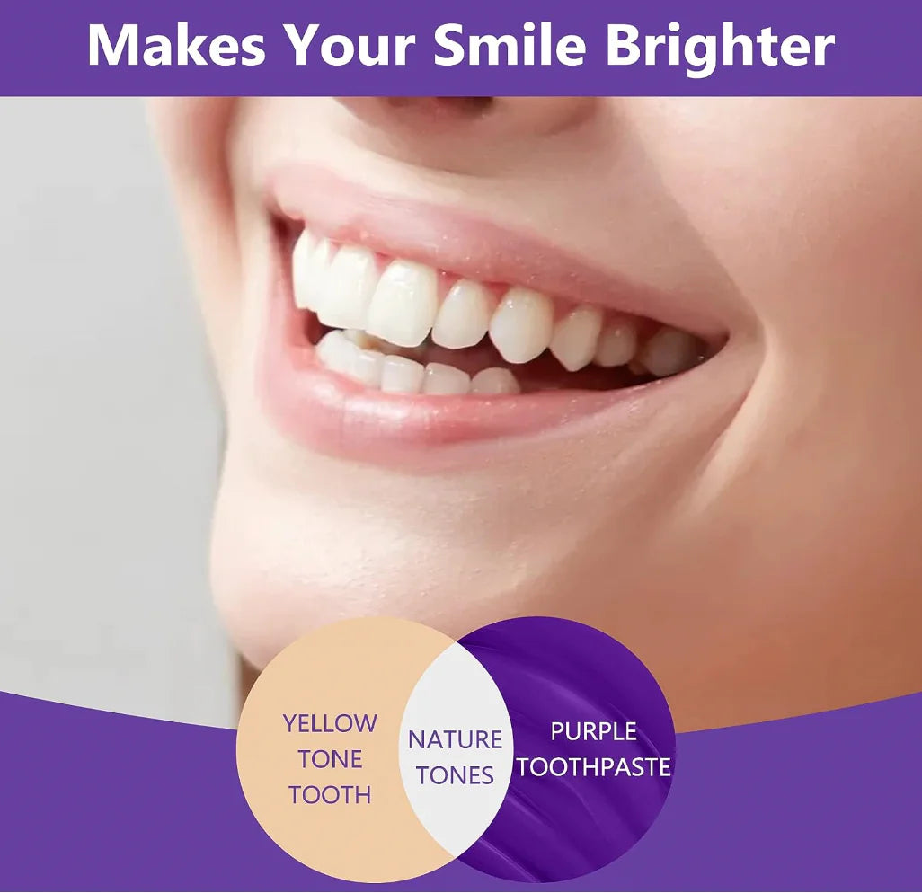 V34 Teeth Whitening & Color Correcting Treatment