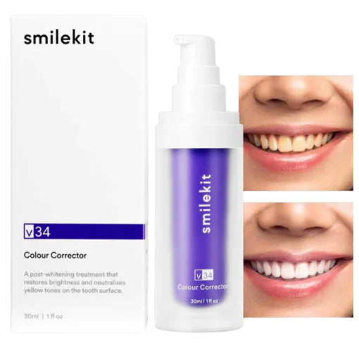 V34 Teeth Whitening & Color Correcting Treatment